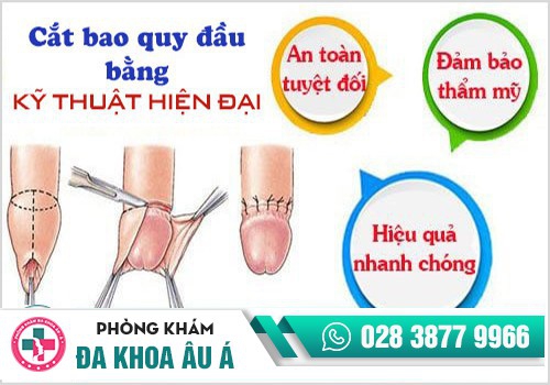 Cắt bao quy đầu bằng kỹ thuật hiện đại được xem là phương pháp tiên tiến hiện nay
