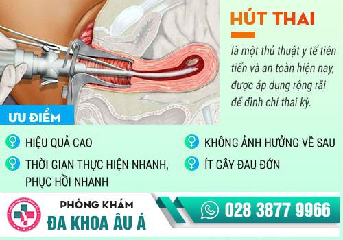 Hút thai bằng ống trực quang siêu dẫn