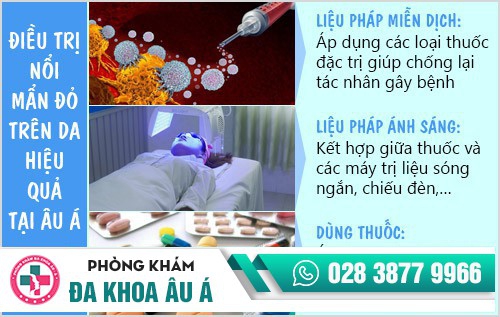 Nổi mẩn đỏ trên da