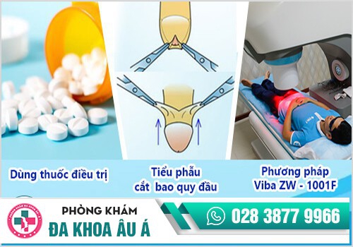 Phương pháp điều trị đau nhức dương vật hiệu quả
