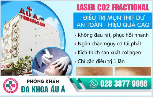 Mụn thịt và giải pháp hỗ trợ điều trị hiệu quả