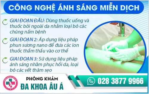 Điều trị nấm da bằng công nghệ ánh sáng miễn dịch