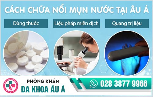chữa nổi mụn nước