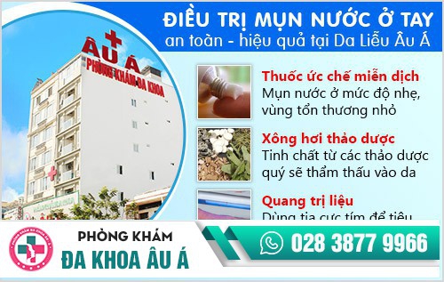 mụn nước ở tay