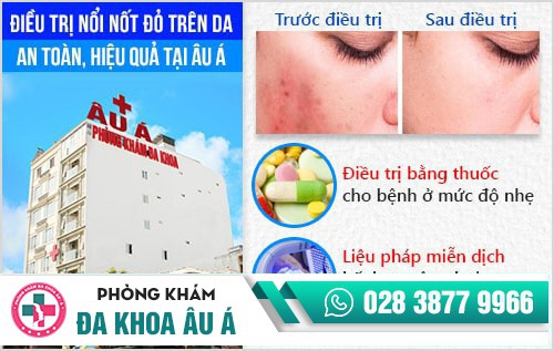 nổi nốt đỏ và ngứa trên da