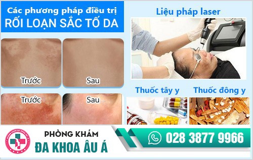 cách trị rối loạn sắc tố da