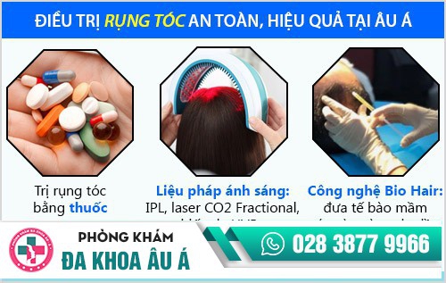 Phương pháp điều trị rụng tóc