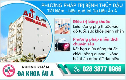 chữa bệnh thủy đậu 