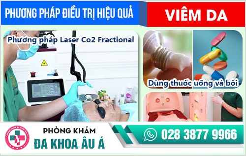Địa chỉ chữa bệnh viêm da uy tín tại TP.HCM