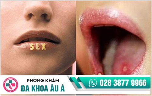 Quan Hệ Tình Dục Bằng Miệng Không Thực Sự An Toàn Như Bạn Nghĩ