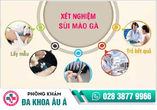 Giá xét nghiệm sùi mào gà
