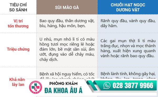 Tất cả những thông tin liên quan đến chuỗi hạt ngọc dương vật