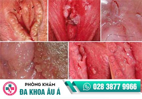 xét nghiệm tổng quát bệnh xã hội