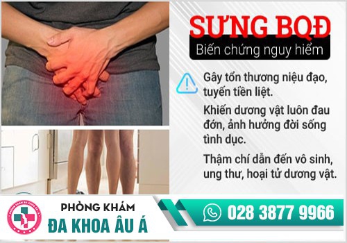 Sưng tấy ở quy đầu dẫn đến nhiều biến chứng nguy hiểm