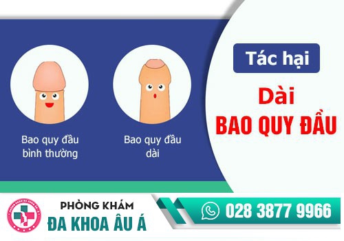 Hình ảnh dài bao quy đầu