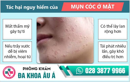 Mụn cóc ở mặt: Dấu hiệu và cách điều trị