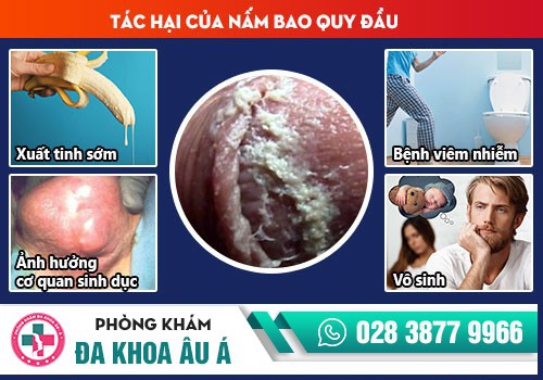Những tác hại nguy hiểm khi bị nấm bao quy đầu ở nam giới