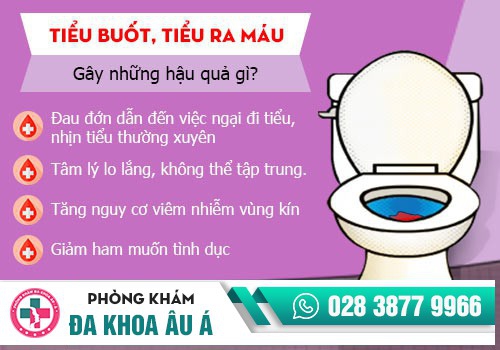 TIỂU RÁT Ở NỮ GIỚI