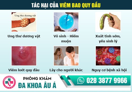 Viêm nhiễm bao quy đầu gây nên nhiều biến chứng nguy hiểm