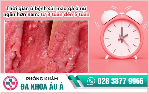 Thời gian ủ bệnh sùi mào gà