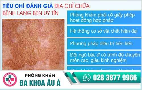 Địa chỉ điều trị lang ben tốt nhất tại TP.HCM