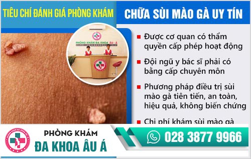 địa chỉ chữa sùi mào gà