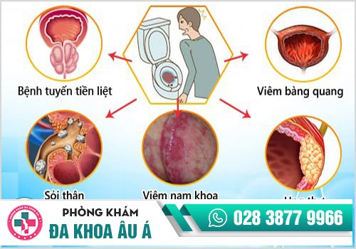 ĐI GIẢI RA MÁU LÀ BỆNH GÌ?
