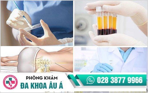 Tìm hiểu về STDs – Phương pháp xét nghiệm STD nhanh chóng, chính xác