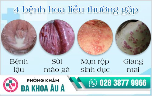 Tìm hiểu về STDs – Phương pháp xét nghiệm STD nhanh chóng, chính xác