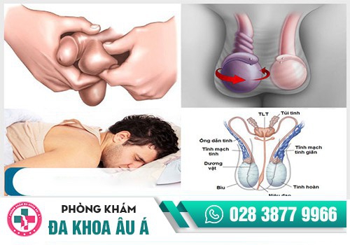 Apxe tinh hoàn điều trị như thế nào?