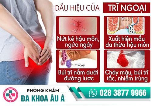 Hình ảnh trĩ ngoại