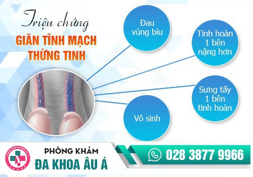 Giãn tĩnh mạch thừng tinh dẫn đến tình trạng đau nhức tinh hoàn