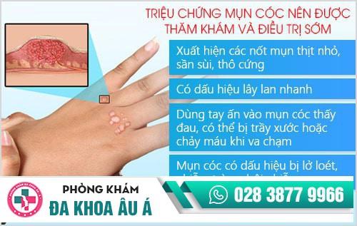 Phòng khám điều trị mụn cóc ở TP.HCM