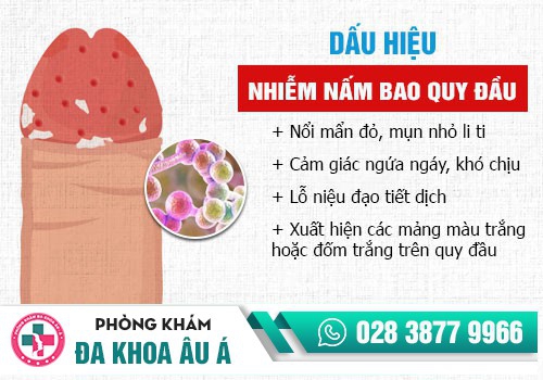 Viêm bao quy đầu do nấm Candida