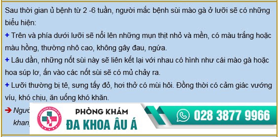 sùi mào gà ở lưỡi