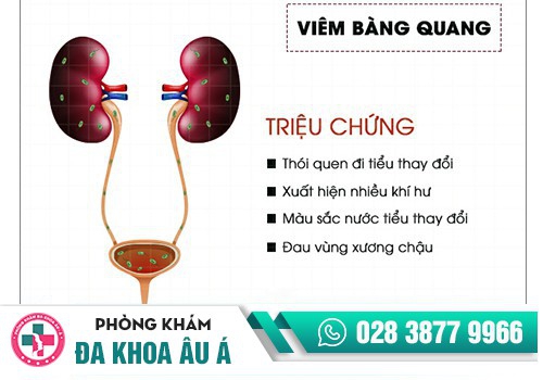 BỆNH BÀNG QUANG LÀ GÌ?