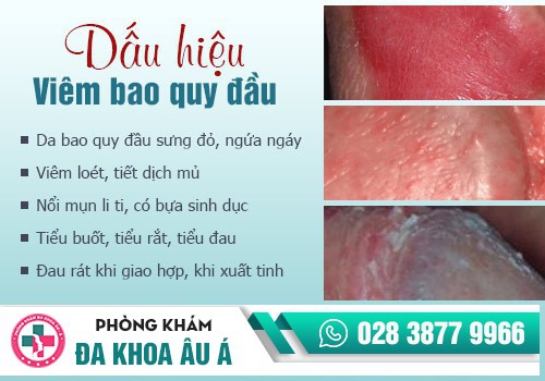 Triệu chứng nhận biết viêm bao quy đầu