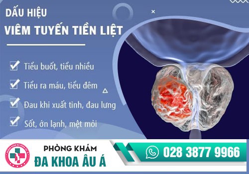 U xơ tuyến tiền liệt là gì?