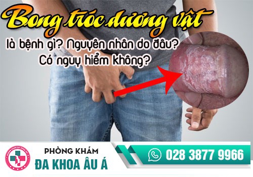 Tróc da dương vật có nguy hiểm không?