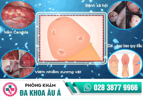 Nguyên nhân tróc da dương vật là gì?