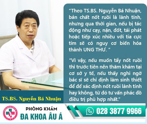 tẩy nốt ruồi
