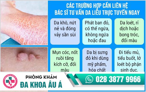 Khi nào nên sử dụng dịch vụ bác sĩ trực tuyến tư vấn da liễu?