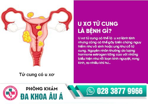 Đau bụng dưới bên phải ở nữ là dấu hiệu của bệnh gì?