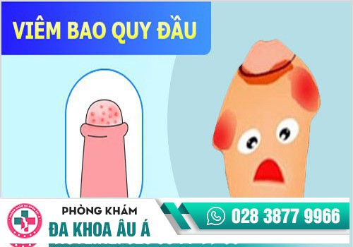 Đau buốt quy đầu do viêm bao quy đầu