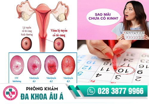 KHÍ HƯ MÀU VÀNG LÀ DẤU HIỆU BỆNH GÌ?