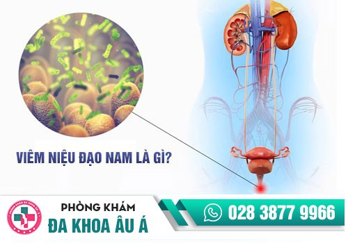 VIÊM NIỆU ĐẠO LÀ GÌ?