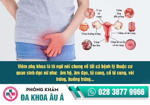 viêm âm đạo