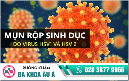 mụn rộp sinh dục