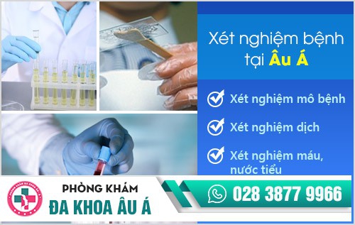 Xét nghiệm sùi mào gà – chẩn đoán nhanh, điều trị kịp thời