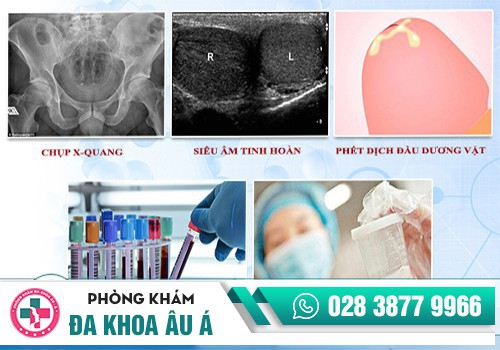 Xét nghiệm ngoại khoa nam giới - việc làm cần thiết